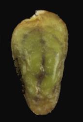 Cardamine porphyroneura. Seed showing purple venation under testa.
 Image: P.B. Heenan © Landcare Research 2019 CC BY 3.0 NZ